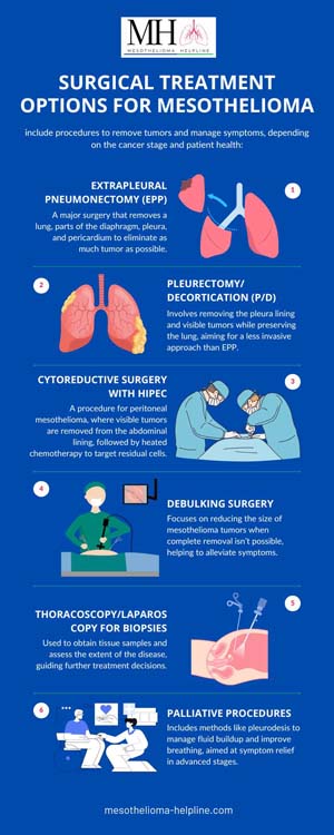 Best Treatment Options for Mesothelioma Cancer